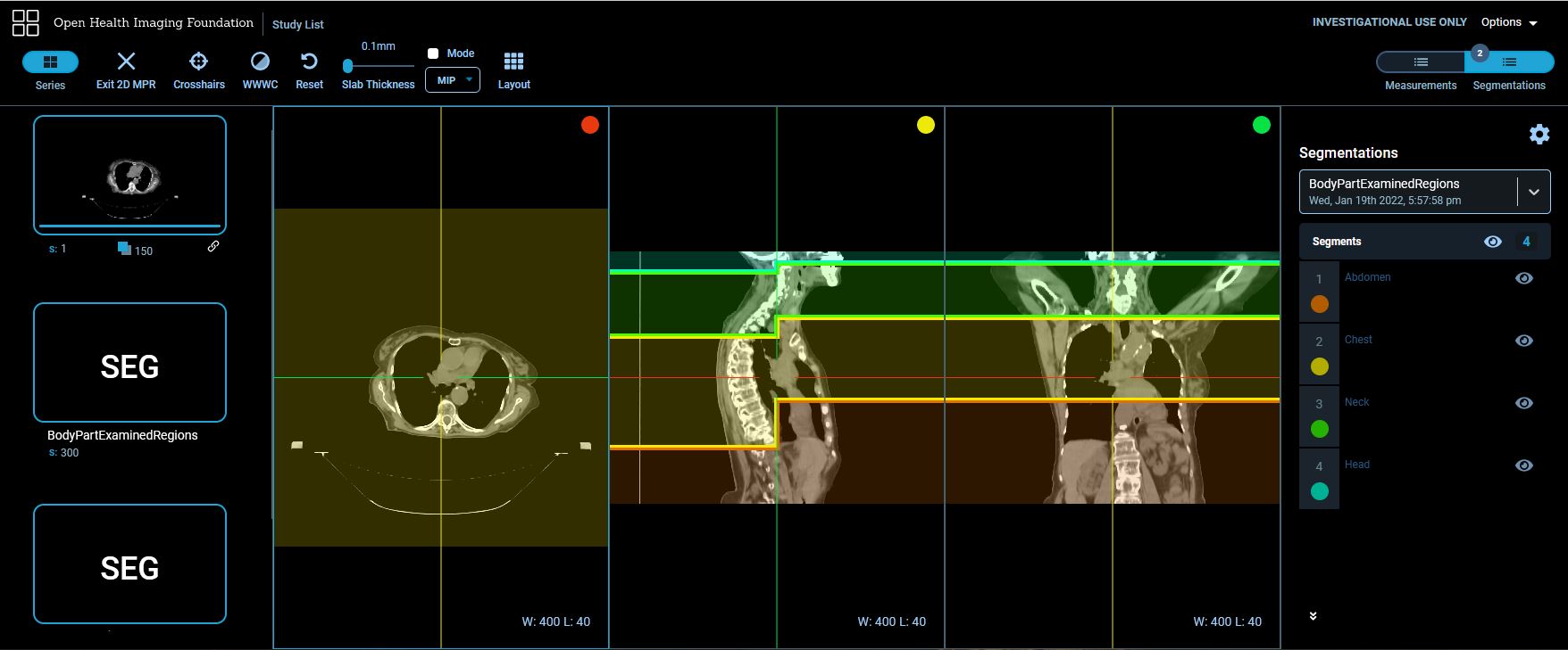 Body part examined predicted regions